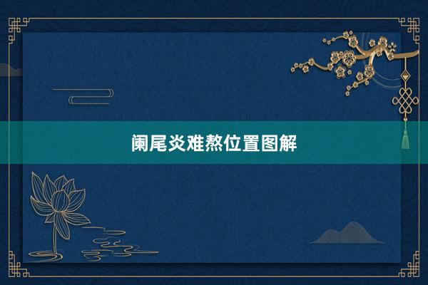 阑尾炎难熬位置图解